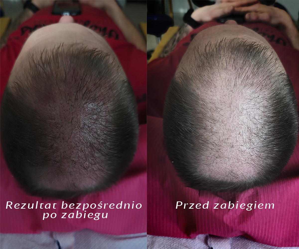 Zdjęcie 1