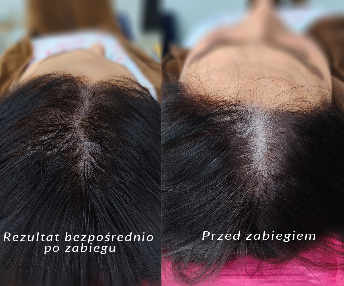 Zdjęcie 2