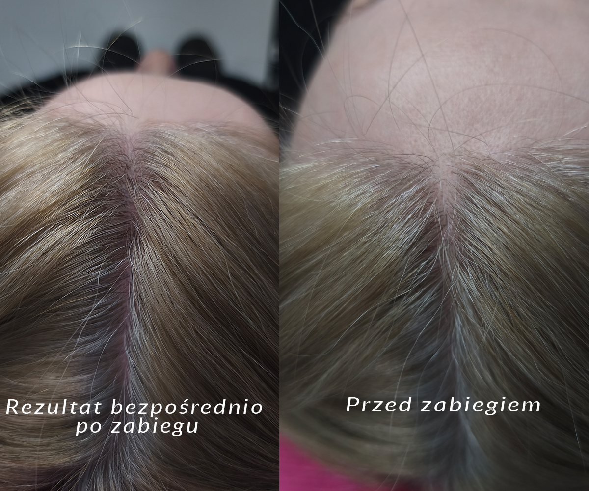 Zdjęcie 2
